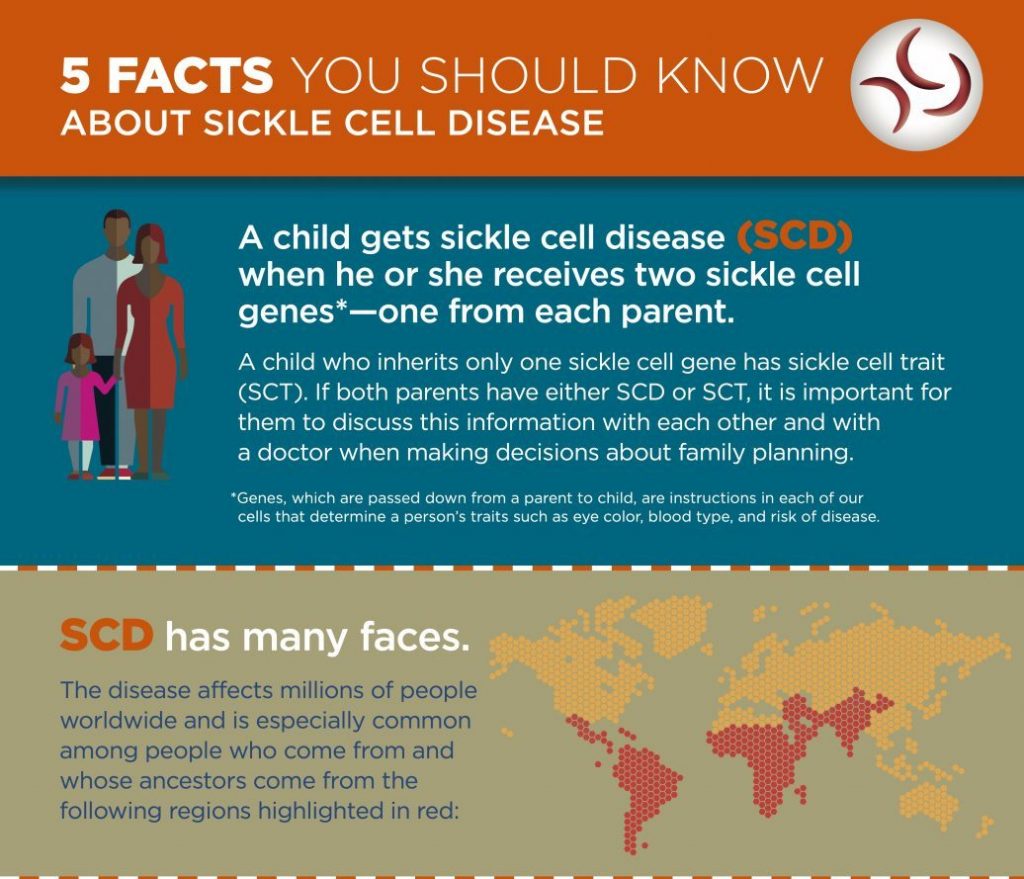 5 Facts About Sickle Cell Disease